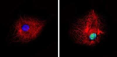 Immunocytochemistry/ Immunofluorescence: PPAR alpha/NR1C1 [p Ser12] Antibody [NB120-3484]